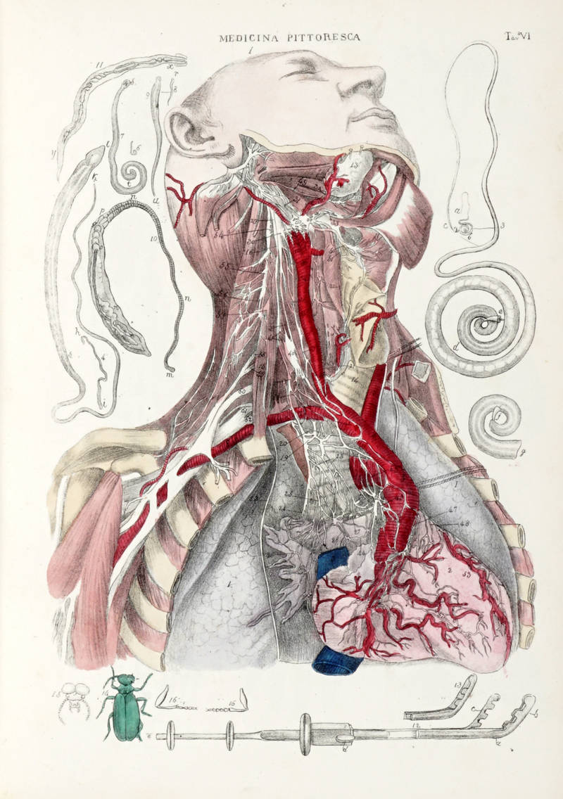 MEDICINA (LA) Pittoresca. Museo Medico-Chirurgico ossia Raccolta completa di tavole litografiche colorate, di Anatomia Generale descrittiva, Patologia e Chirurgia...Con un testo esplicativo esteso...Opera tradotta dal Francese arrichhita di note e di molt