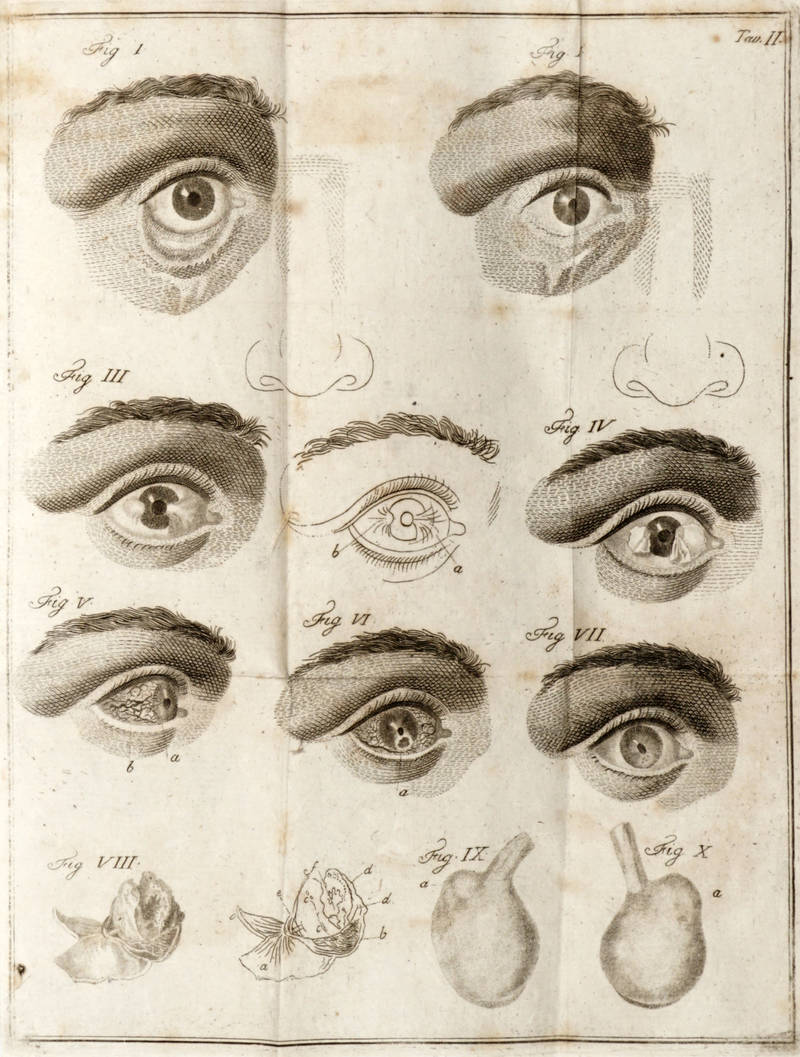Saggio di osservazioni e di esperienze sulle principali malattie degli occhi.. .Tomo Primo (-terzo). Saggio di osservazioni e di esperienze sulle principali malattie degli occhi.. .Tomo Primo (-terzo).